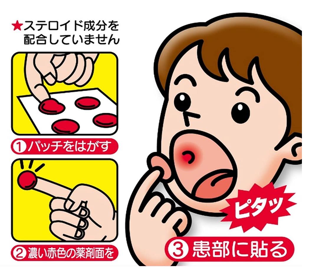 大正制药 口腔溃疡药贴 10枚