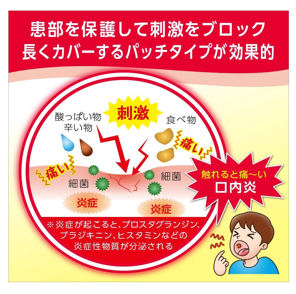 大正制药 口腔溃疡药贴 10枚